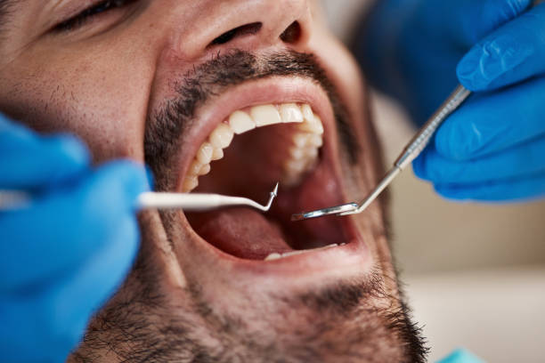 Best Full Mouth Reconstruction  in Scottsburg, IN
